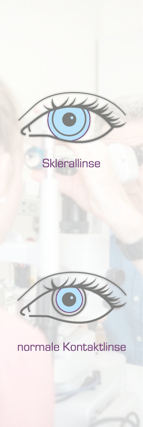 sklerallinsen im sehzentrum zuerich